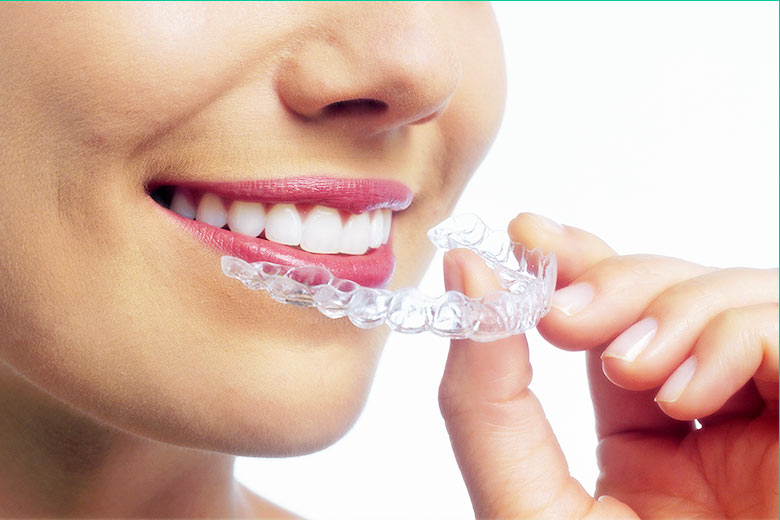 Transform Your Smile With Invisalign In Toronto